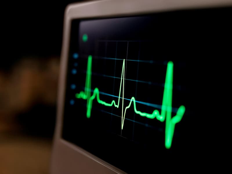 Comprar electrocardiógrafo certificado y homologado - Vilagarcía de Arousa